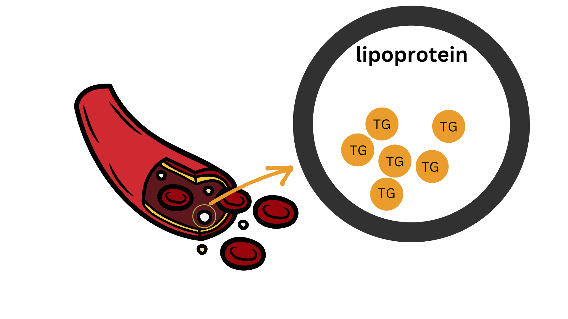 Diagram of lipoprotein pathways in the blood for reversing type 2 diabetes