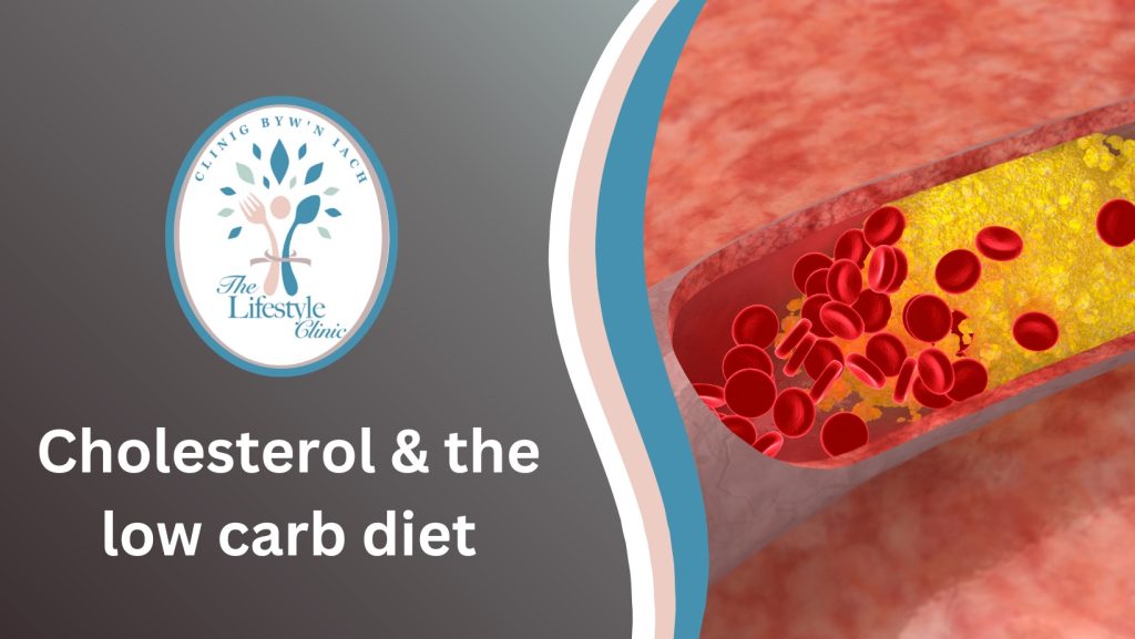 cholesterol training